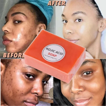 Load image into Gallery viewer, kojic Acid Skin Lightning Soap/Anti Acne 100 gram (1 bar)