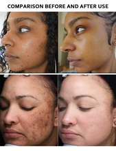 Load image into Gallery viewer, 5D gluta booster  whitenizer complexion clarifying milk serum 100mlx1