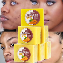 Load image into Gallery viewer, Turmeric Soap Skin Whitening Dark Spots lightening Acne Brightening Turmeric