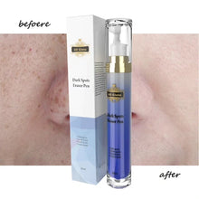 Load image into Gallery viewer, Eraser Roller Pen For Remove Dark Spots & Acne Spots  And Face Scars Mark Eraser Pen  Eyes Care