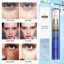 Load image into Gallery viewer, Eraser Roller Pen For Remove Dark Spots & Acne Spots  And Face Scars Mark Eraser Pen  Eyes Care