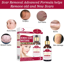 Load image into Gallery viewer, Scar Removal Cream For Old Scars Stretch Mark Spots serum for Men & Women