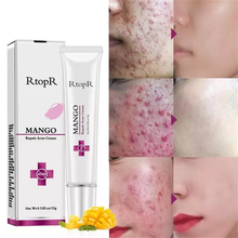 Load image into Gallery viewer, RtopR Mango Acne Whitening Moisturizing Face Blemish Cream Anti-acne Treatment