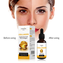 Load image into Gallery viewer, Retinol + Hyaluronic Acid & Collagen 0CREAM Serum Anti-Aging Wrinkle GEL-