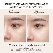 Load image into Gallery viewer, Ailke Kojic Acid whitening Day Night Dark Spot Anti Freckle Moisturizing sun burn face cream  2 in 1