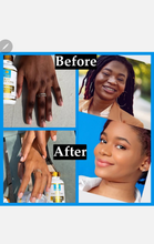 Load image into Gallery viewer, Glutathione Super Lightening Capsules 15000mg Includes Collagen & Vitamin C