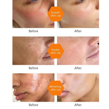 Load image into Gallery viewer, kojic Acid Skin Lightning Soap/Anti Acne 100 gram (1 bar)
