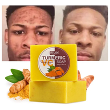 Load image into Gallery viewer, Tumeric Soap Skin Whitening Dark Spots lightening Acne Brightening Turmeric
