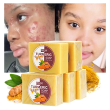 Load image into Gallery viewer, Turmeric Soap Skin Whitening Dark Spots lightening Acne Brightening Turmeric
