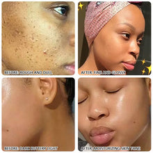 Load image into Gallery viewer, 100% natural   Fruits rejuvenating nourishing vitamin c korean face masks -10 pieces
