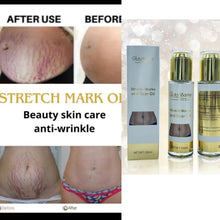 Load image into Gallery viewer, Gluta Master Stretch Marks Remover Anti Scar Oil with Collagen Clarify Skin Repair Anti-Aging Anti-Wrinkle For Pregnant Oil
