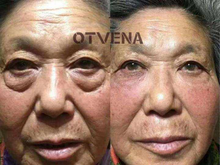 Load image into Gallery viewer, 5 Seconds Wrinkle Remover Instant Anti-Aging Face Cream Skin Tightening Firming
