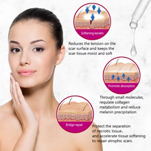 Load image into Gallery viewer, Scar Removal Cream For Old Scars Stretch Mark Spots serum for Men &amp; Women
