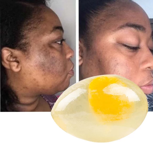 Original Collagen Egg Soap with Vitamin C and E