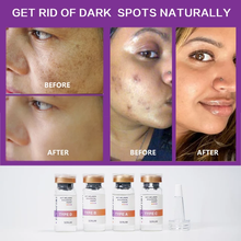 Load image into Gallery viewer, whitening, Lightening Face Brightening serum for Dark spot, melasma, freckles, pigmentation 
removal 
Face serum
