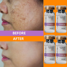 Load image into Gallery viewer, whitening, Lightening Face Brightening serum for Dark spot, melasma, freckles, pigmentation 
removal 
Face serum
