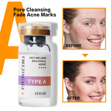 Load image into Gallery viewer, whitening, Lightening Face Brightening serum for Dark spot, melasma, freckles, pigmentation 
removal 
Face serum
