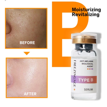 Load image into Gallery viewer, whitening, Lightening Face Brightening serum for Dark spot, melasma, freckles, pigmentation 
removal 
Face serum
