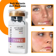 Load image into Gallery viewer, whitening, Lightening Face Brightening serum for Dark spot, melasma, freckles, pigmentation 
removal 
Face serum
