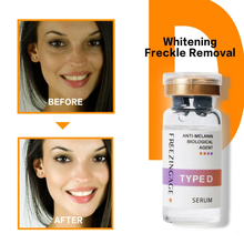 Load image into Gallery viewer, whitening, Lightening Face Brightening serum for Dark spot, melasma, freckles, pigmentation 
removal 
Face serum

