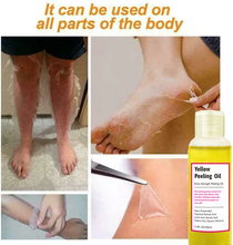 Load image into Gallery viewer, Orange Peeling Lotion Body Whitening Cream Lightening Brightening joint dark oil

