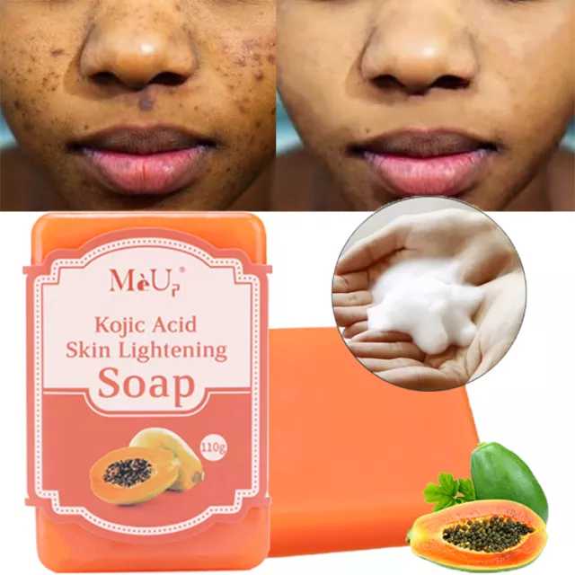 Koji White Kojic Acid & Papaya Skin Brightening Soap