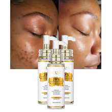 Load image into Gallery viewer, 100% orginal ailke vitamin c set,lotion,serum,face cream
