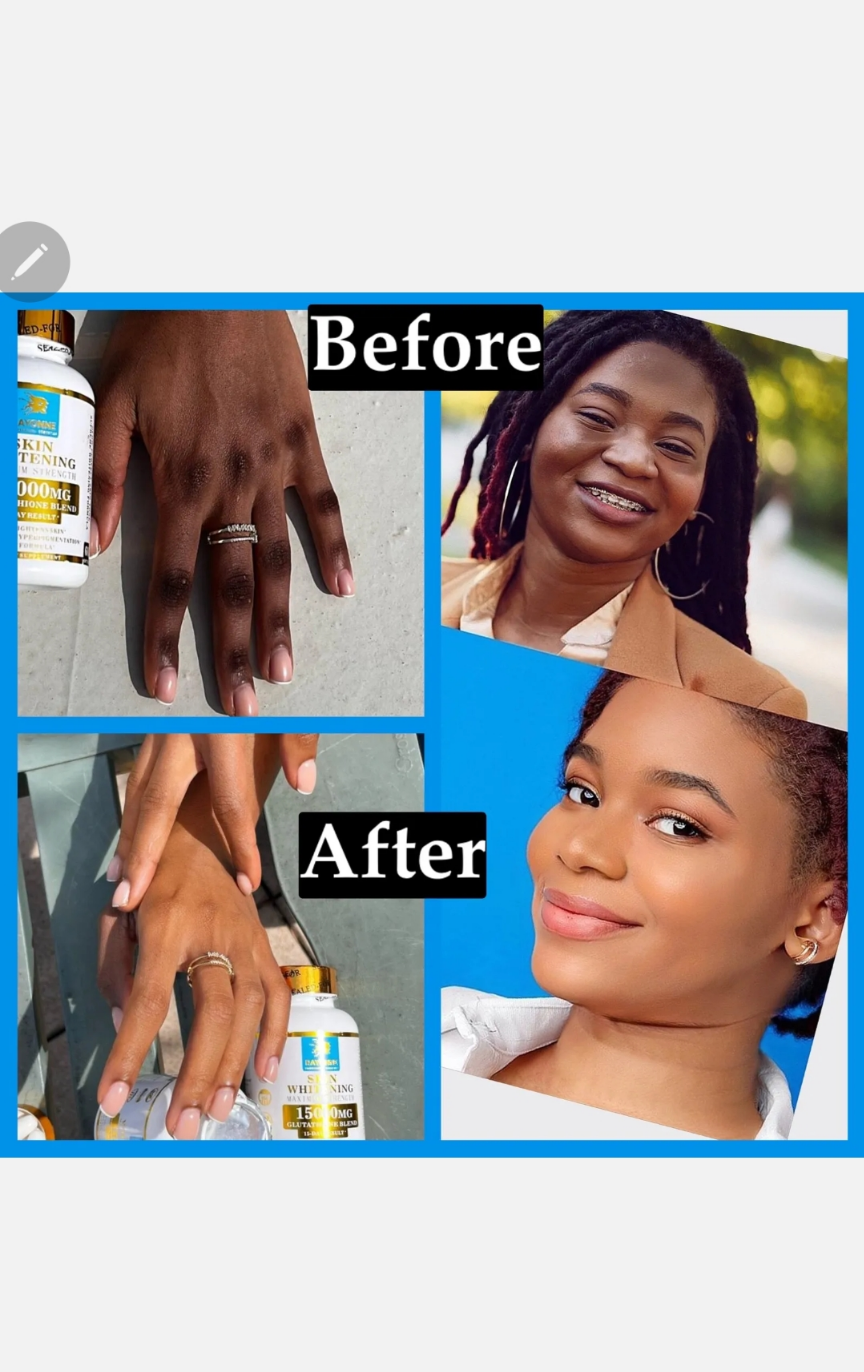 Glutathione Super Lightening Capsules 15000mg Includes Collagen & Vitamin C