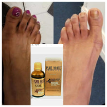 Load image into Gallery viewer, PURE WHITE GOLD SERUM fast action black spot remover. Fast whitening serum.
